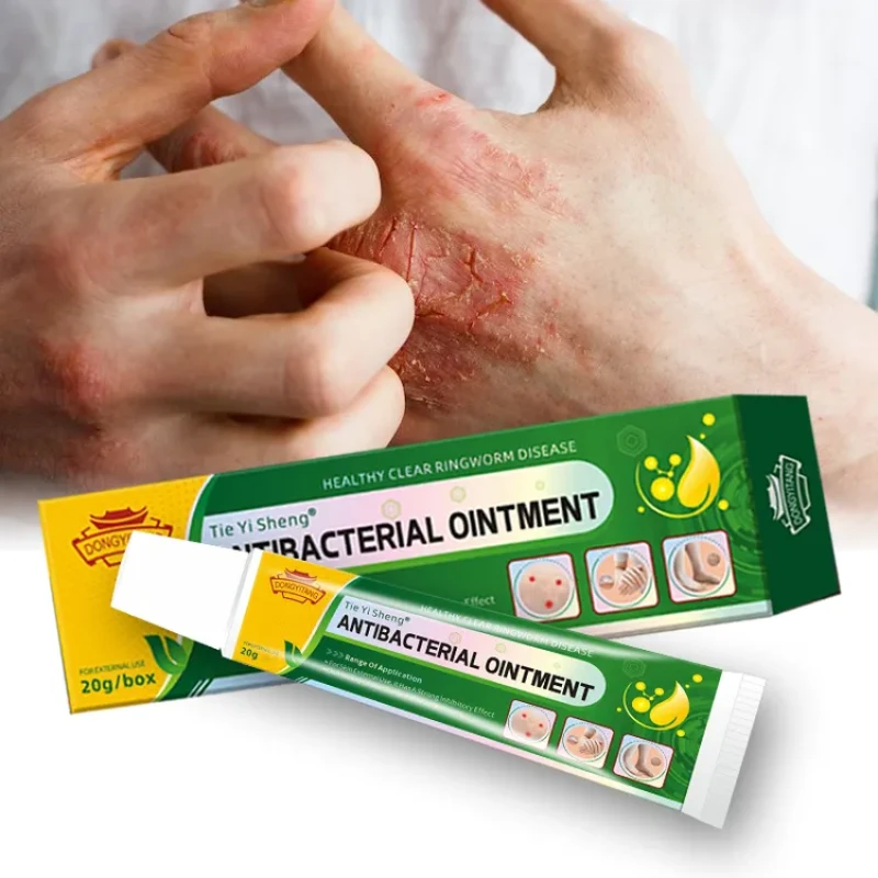 Tie Yi Sheng Antibacterial Ointment-1 Pcs