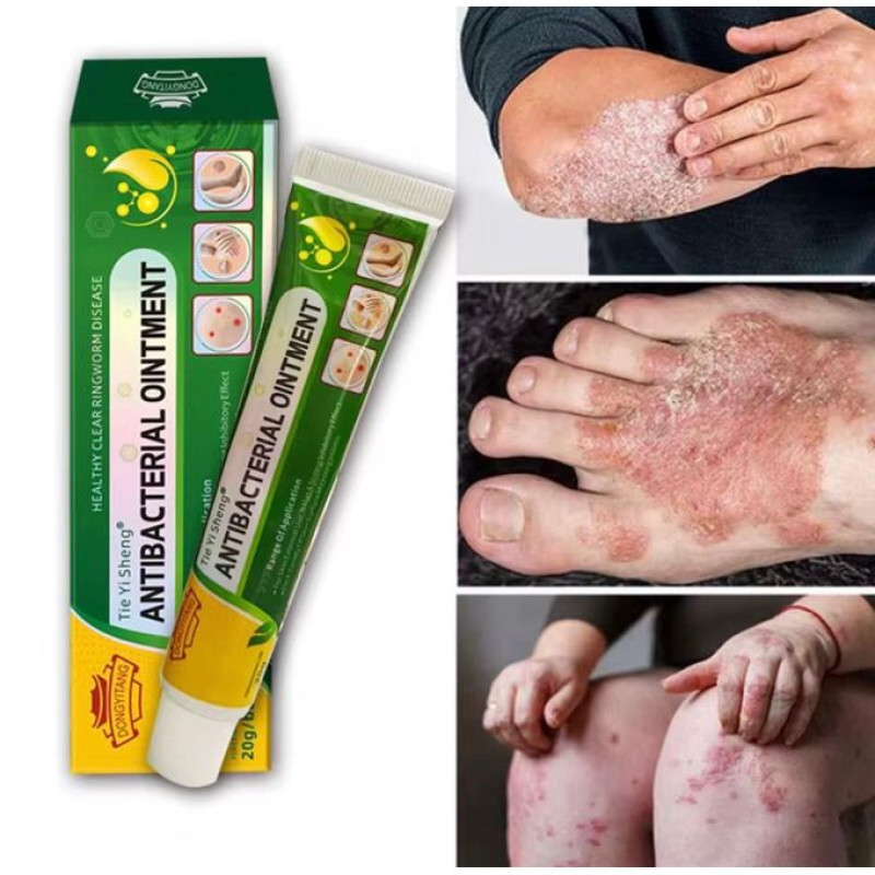Tie Yi Sheng Antibacterial Ointment-3 Pcs